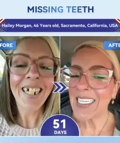 𝐇𝐞𝐚𝐥𝐫𝐢𝐳𝐞® Tideglusib Fast‑Dissolving Tooth & Gum Repair Oral Strips