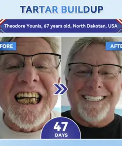 𝐇𝐞𝐚𝐥𝐫𝐢𝐳𝐞® Tideglusib Fast‑Dissolving Tooth & Gum Repair Oral Strips