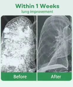 Healrize® 𝐇𝐞𝐫𝐛𝐚𝐥 𝐋𝐮𝐧𝐠 𝐂𝐥𝐞𝐚𝐧𝐬𝐢𝐧𝐠 𝐈𝐧𝐡𝐚𝐢𝐞𝐫