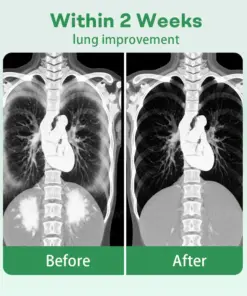 Healrize® 𝐇𝐞𝐫𝐛𝐚𝐥 𝐋𝐮𝐧𝐠 𝐂𝐥𝐞𝐚𝐧𝐬𝐢𝐧𝐠 𝐈𝐧𝐡𝐚𝐢𝐞𝐫