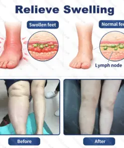 Healrize® Advanced Edema Relief Cream