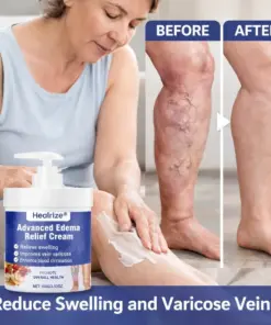 Healrize® Advanced Edema Relief Cream