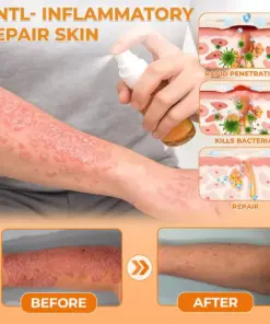 Healrize® Bee Venom Antifungal & Antibacterial Spray