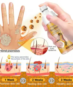 Healrize® Bee Venom Antifungal & Antibacterial Spray