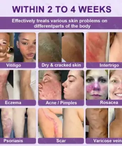 Healrize® Biotin 10-in-1 Skin Restoration Cream