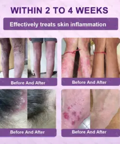 Healrize® Biotin 10-in-1 Skin Restoration Cream