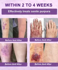 Healrize® Biotin 10-in-1 Skin Restoration Cream