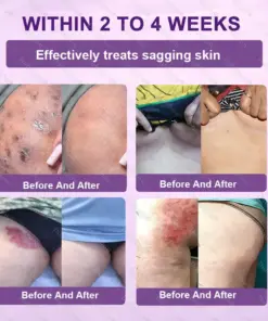 Healrize® Biotin 10-in-1 Skin Restoration Cream