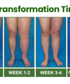 Healrize® Light Legs Swelling & Circulation Relief Spray