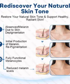 Healrize® Piperine Vitiligo Repigmentation Spray