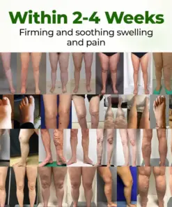 Healrize® Professional Leg Circulation Cream