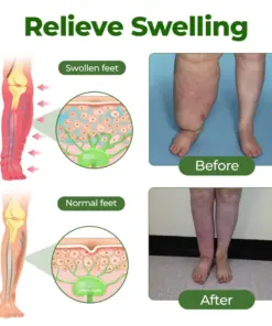 Healrize® Professional Leg Circulation Cream