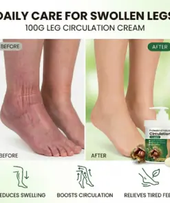 Healrize® Professional Natural Leg Circulation Cream