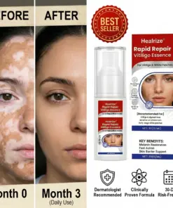 Healrize® Rapid Repair Vitiligo Essence