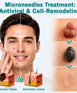 ๐๐๐๐๐ฟ๐ถ๐ฏ๐ยฎ2-in-1 Microneedle & Hydrocolloid Patch