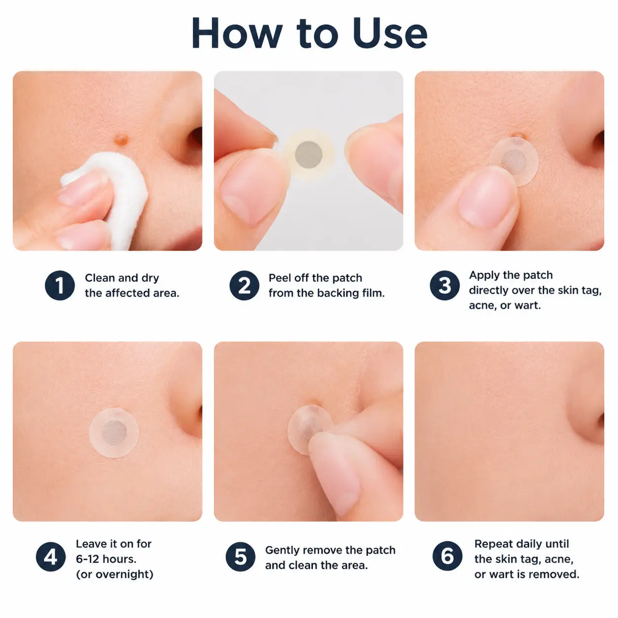 ๐๐๐๐๐ฟ๐ถ๐ฏ๐ยฎ2-in-1 Microneedle & Hydrocolloid Patch