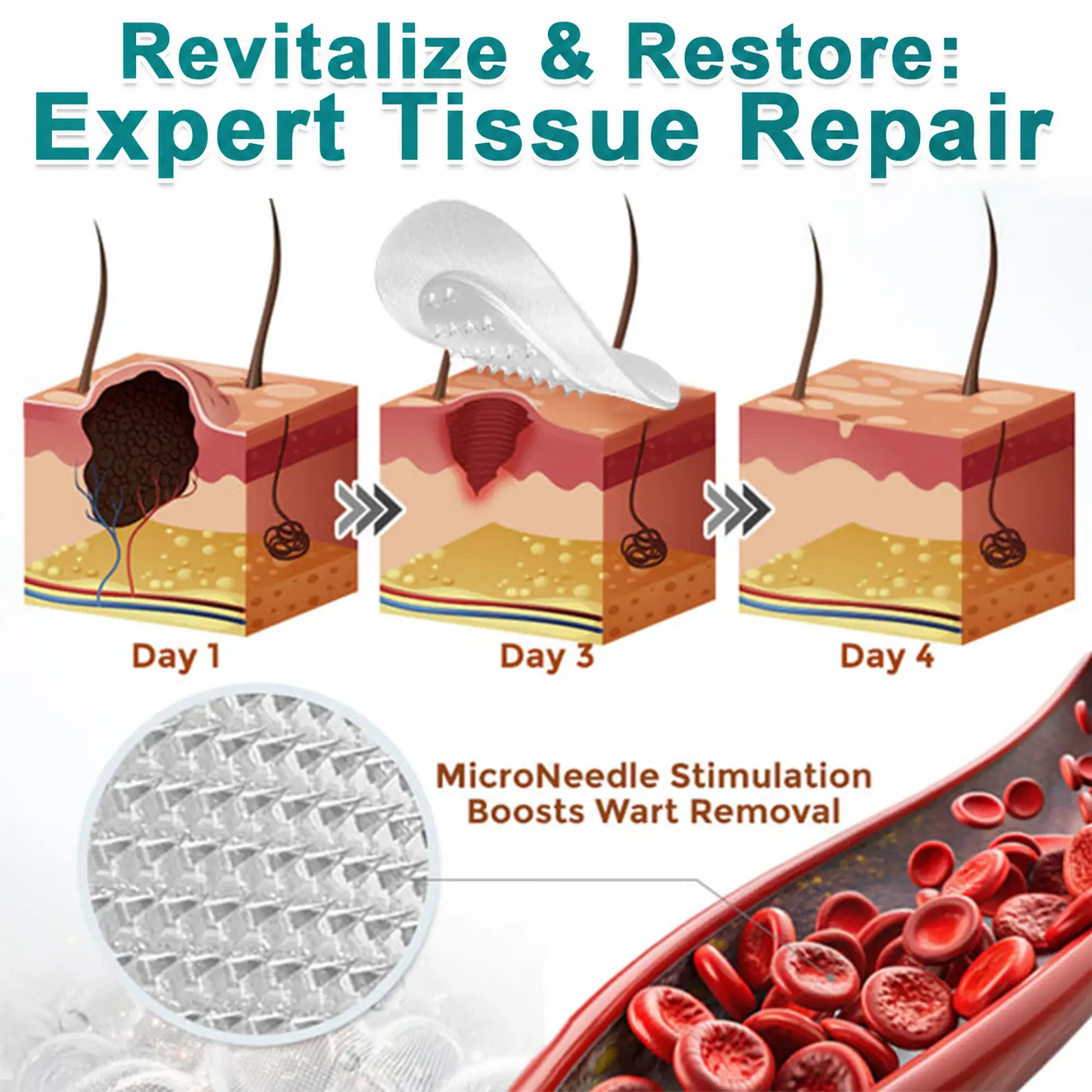 ๐๐๐๐๐ฟ๐ถ๐ฏ๐ยฎ2-in-1 Microneedle & Hydrocolloid Patch