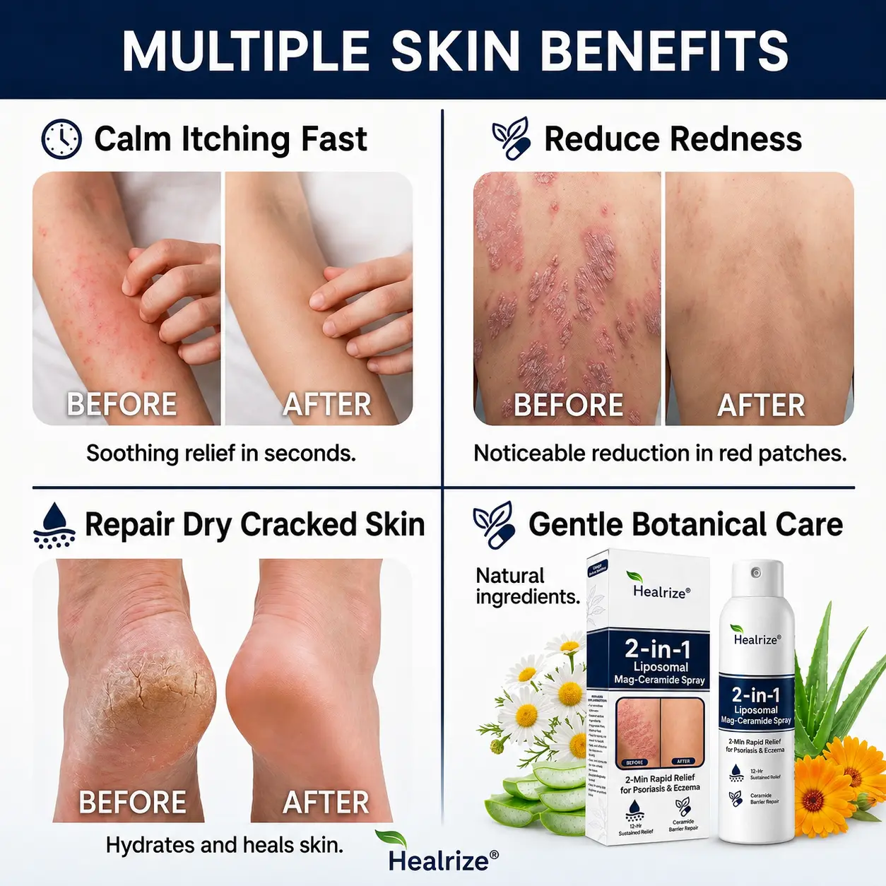 Healrize® 2-in-1 Liposomal Mag-Ceramide Spray