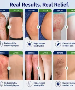 Healrize® 2-in-1 Liposomal Mag-Ceramide Spray