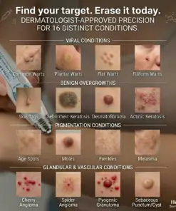 Healrize® 7-Day Skin Tag & Spot Eraser Painless & Scar-Free Advanced Imperfection Removal Rollerball Pen