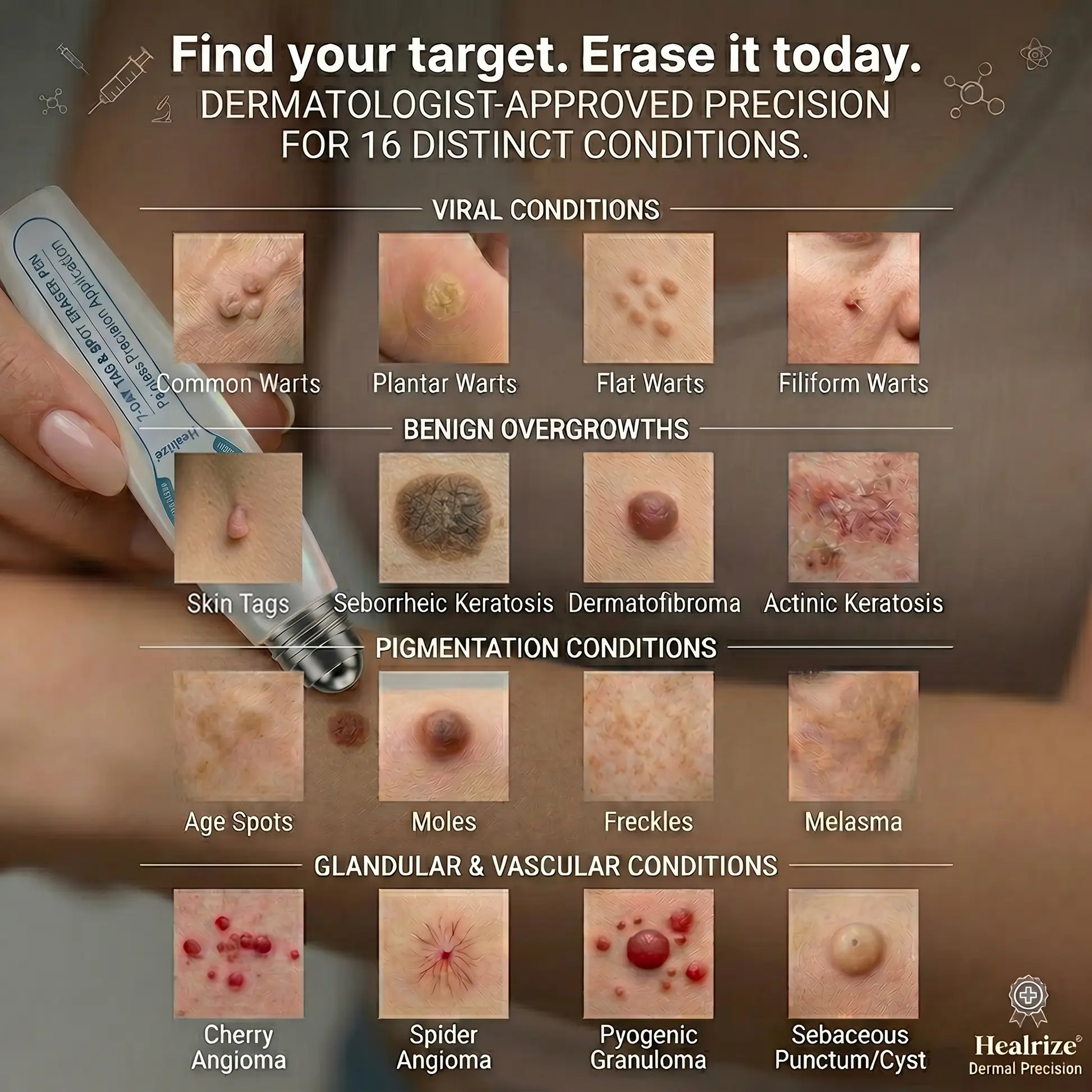 Healrize® 7-Day Skin Tag & Spot Eraser Painless & Scar-Free Advanced Imperfection Removal Rollerball Pen