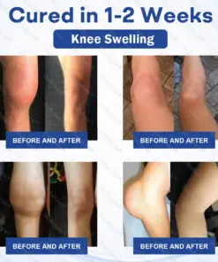 Healrize® Knee Joint Pain Relief Patches