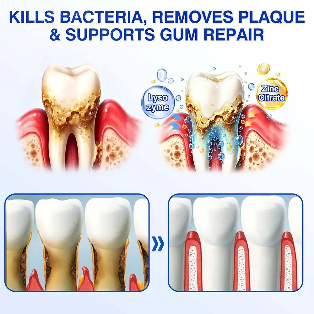 Healrize® GumRevive gel