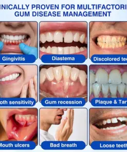Healrize® GumRevive gel