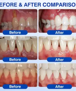 Healrize® GumRevive gel