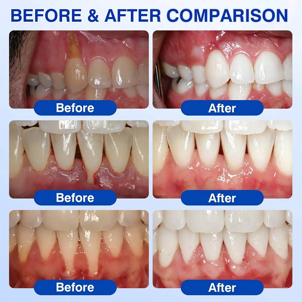 Healrize® GumRevive gel