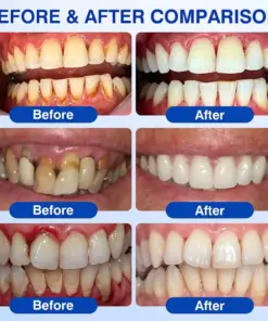 Healrize® GumRevive gel