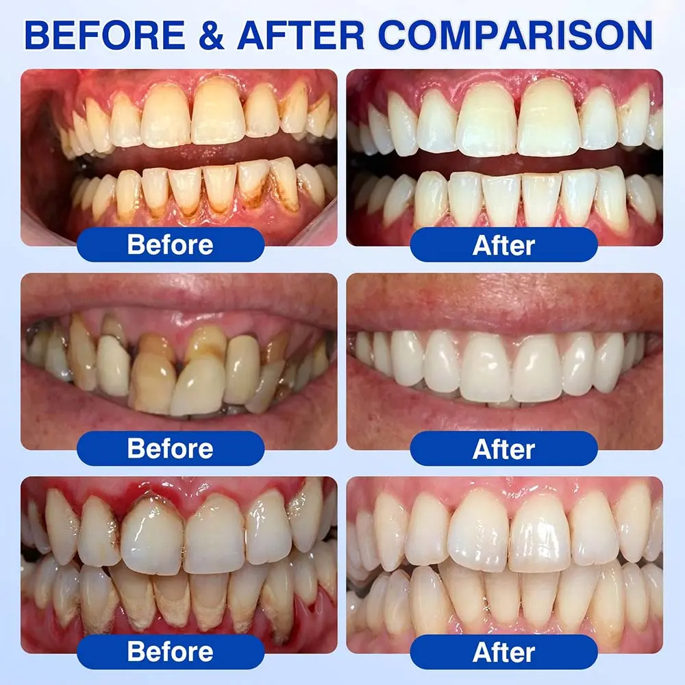 Healrize® GumRevive gel