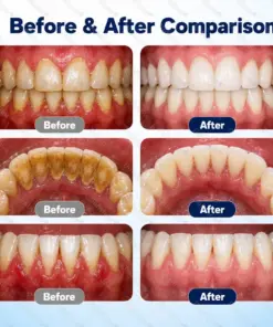 Healrize® Oral Repair Liquid