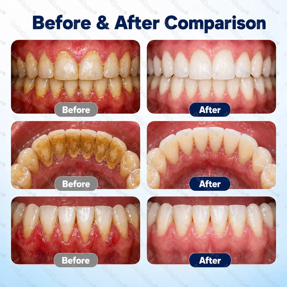 Healrize® Oral Repair Liquid