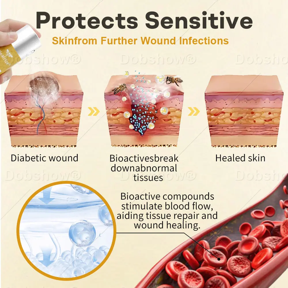 Healrize®GlucoShield Wound Spray