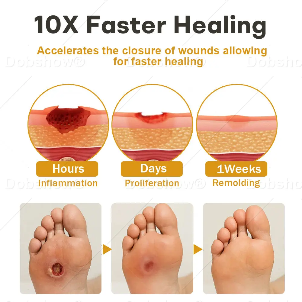 Healrize®GlucoShield Wound Spray