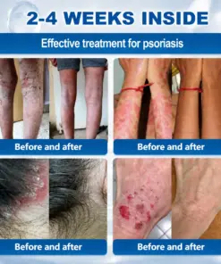 𝐇𝐞𝐚𝐥𝐫𝐢𝐳𝐞® 𝟕-𝐃𝐚𝐲 𝐒𝐤𝐢𝐧 𝐓𝐚𝐠 & 𝐒𝐩𝐨𝐭 𝐄𝐫𝐚𝐬𝐞𝐫 𝐂𝐫𝐞𝐚𝐦