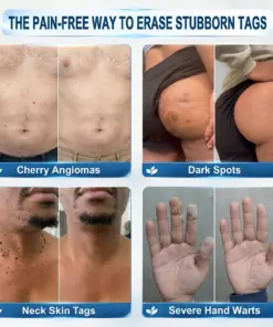𝐇𝐞𝐚𝐥𝐫𝐢𝐳𝐞® 𝟕-𝐃𝐚𝐲 𝐒𝐤𝐢𝐧 𝐓𝐚𝐠 & 𝐒𝐩𝐨𝐭 𝐄𝐫𝐚𝐬𝐞𝐫 𝐂𝐫𝐞𝐚𝐦