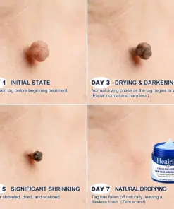 𝐇𝐞𝐚𝐥𝐫𝐢𝐳𝐞® 𝟕-𝐃𝐚𝐲 𝐒𝐤𝐢𝐧 𝐓𝐚𝐠 & 𝐒𝐩𝐨𝐭 𝐄𝐫𝐚𝐬𝐞𝐫 𝐂𝐫𝐞𝐚𝐦
