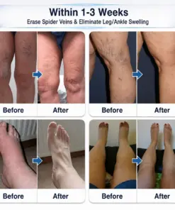 𝑯𝗲𝙖𝐥𝒓𝗶𝙯𝗲® 0.05 mm Premium Micro-Tip Rollers for Vein Care