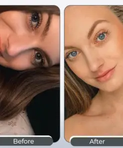 Healrize® EyeCandy Drops