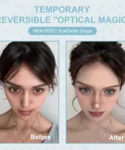 Healrize® EyeCandy Drops